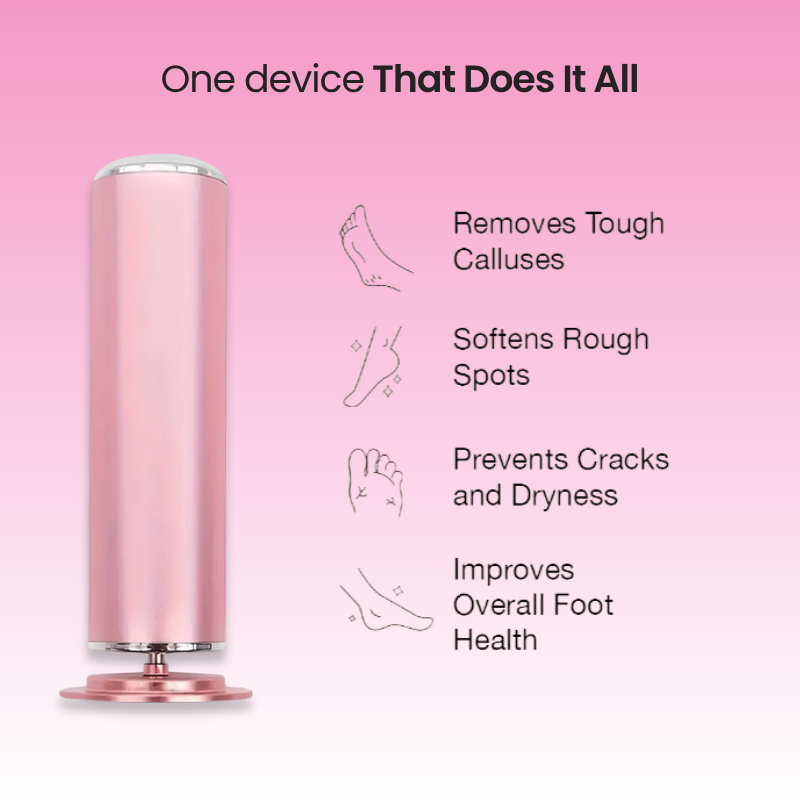 Sofitte™ Electric Foot Callus Remover
